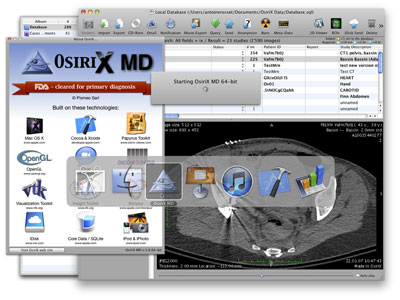 OsiriX MD image