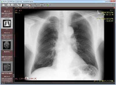 RadiAnt DICOM Viewer  12 months of software updates and email support